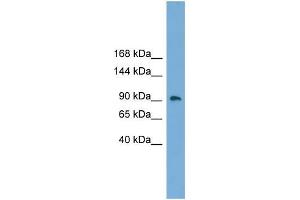 Human Placenta; WB Suggested Anti-ZNF226 Antibody Titration: 0. (ZNF226 Antikörper  (Middle Region))