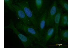 Immunofluorescence (IF) image for anti-Snail Family Zinc Finger 2 (SNAI2) (AA 97-169) antibody (ABIN520276)