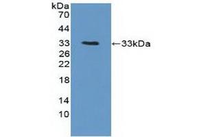 Detection of Recombinant PTK6, Human using Polyclonal Antibody to Protein Tyrosine Kinase 6 (PTK6) (PTK6 Antikörper  (AA 191-445))