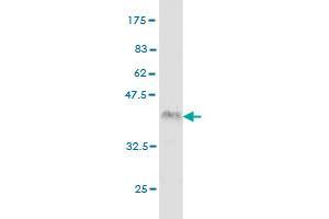 Western Blot detection against Immunogen (36. (IRAK2 Antikörper  (AA 111-210))