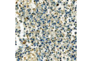 IHC analysis of Hexokinase 1/HK1 using anti-Hexokinase 1/HK1 antibody (ABIN7600259). (Hexokinase 1 Antikörper  (AA 17-323))