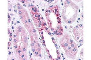 Anti-CASR/Calcium Sensing Receptor antibody IHC of human kidney, diabetes. (CASR Antikörper  (N-Term))
