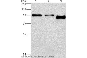 Western blot analysis of A431 and hela cell,mouse brain tissue, using PIP5K1C Polyclonal Antibody at dilution of 1:500 (PIP5K1C Antikörper)