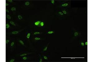 Immunofluorescence of purified MaxPab antibody to SFRS14 on HeLa cell. (SFRS14 Antikörper  (AA 1-988))
