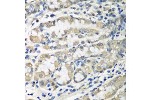 Immunohistochemistry of paraffin-embedded human stomach using CCT6A antibody (ABIN5974448) at dilution of 1/100 (40x lens). (CCT6A Antikörper)