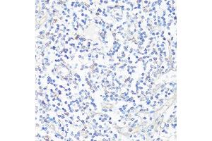 Immunohistochemistry of paraffin-embedded human tonsil using CASP3 antibody. (Caspase 3 Antikörper  (AA 55-160))