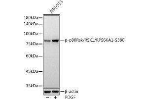 Western blot analysis of extracts of NIH/3T3 cells, using Phospho-p90Rsk/RSK1/RPS6K-S380 antibody (ABIN7270036) at 1:1000 dilution. (RPS6KA1 Antikörper  (pSer380))