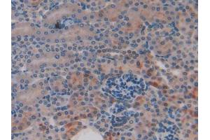 Figure. (CYR61 Antikörper  (AA 176-379))