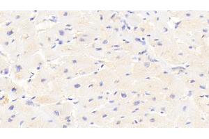 Detection of GABARAPL2 in Human Cardiac Muscle Tissue using Polyclonal Antibody to GABA-A Receptor Associated Protein Like Protein 2 (GABARAPL2) (GABARAPL2 Antikörper  (AA 1-117))