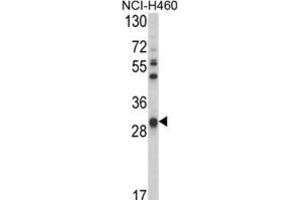 Western Blotting (WB) image for anti-Glutathione S-Transferase omega 1 (GSTO1) antibody (ABIN3001725)