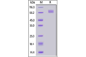 SARS-CoV-2 Spike S2 Protein (B.1.351 - beta) (His tag)