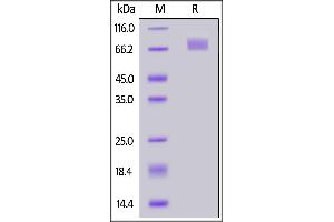 SARS-CoV-2 S2 protein (A701V), His Tag on  under reducing (R) condition.