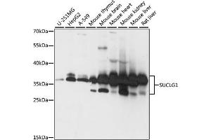 Western blot analysis of extracts of various cell lines, using SUCLG1 antibody (ABIN7270623) at 1:1000 dilution.
