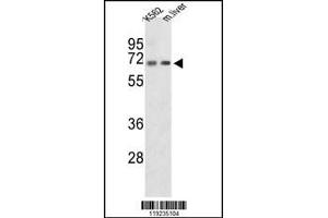 Western blot analysis of CROT Antibody in K562 cell line and mouse liver tissue lysates (35ug/lane) (CROT Antikörper  (N-Term))