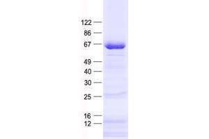 Western Blotting (WB) image for Zinc Finger Protein 278 (ZNF278) protein (His tag) (ABIN2735981)