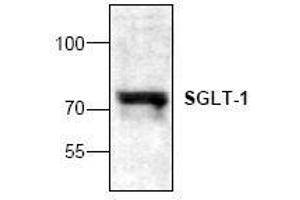 Image no. 1 for anti-Solute Carrier Family 5 (Sodium/glucose Cotransporter), Member 1 (SLC5A1) antibody (ABIN127319)
