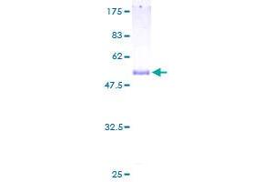 PGLS Protein (AA 1-258) (GST tag)