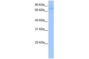 WB Suggested Anti-ZNF440 Antibody Titration:  0.