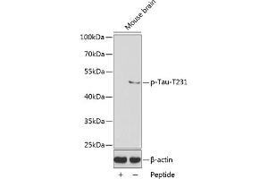 Western blot analysis of extracts from mouse brain tissue using Phospho-Tau-T231 antibody . (MAPT Antikörper  (pThr231))