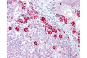 Anti-DAK antibody IHC of human tonsil. (DAK Antikörper  (N-Term))