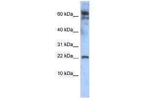 LDOC1 antibody used at 0.