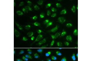 Immunofluorescence analysis of MCF-7 cells using IL7 Polyclonal Antibody (IL-7 Antikörper)