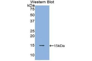 Detection of Recombinant POTEJ, Human using Polyclonal Antibody to POTE Ankyrin Domain Family, Member J (POTEJ) (POTEJ Antikörper  (AA 109-269))