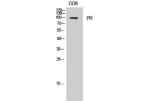 Western Blotting (WB) image for anti-PR (Thr231) antibody (ABIN3177000) (PR (Thr231) Antikörper)