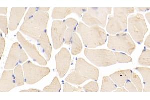 Immunohistochemistry (IHC) image for anti-Bone Morphogenetic Protein 2 (BMP2) (AA 281-394) antibody (ABIN7430393)