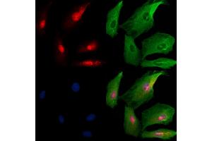 ABIN6259580 and ABIN6273739 staining  cells by IF/ICC. (PROP1 Antikörper  (Internal Region))