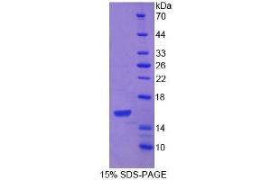 SDS-PAGE analysis of Mouse PDGFC Protein. (PDGFC Protein)