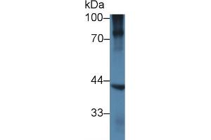 Detection of NKX6-1 in Human BXPC3 cell lysate using Polyclonal Antibody to NK6 Homeobox Protein 1 (NKX6-1) (NKX6-1 Antikörper  (AA 1-367))