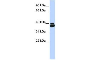 Western Blotting (WB) image for anti-Orthopedia Homeobox (OTP) antibody (ABIN2458104) (OTP Antikörper)