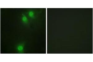Immunofluorescence analysis of HeLa cells, using NEK9 (Phospho-Thr210) Antibody. (NEK9 Antikörper  (pThr210))