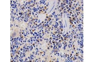 Immunohistochemistry of paraffin-embedded Rat spleen using PSMD3 Polyclonal Antibody at dilution of 1:200 (40x lens). (PSMD3 Antikörper)