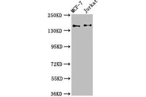 Western Blot Positive WB detected in: MCF-7 whole cell lysate, Jurkat whole cell lysate All lanes: KTN1 antibody at 3. (KTN1 Antikörper  (AA 978-1116))