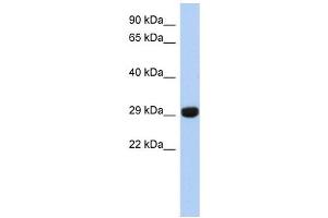 FN3KRP antibody used at 1 ug/ml to detect target protein. (FN3KRP Antikörper  (N-Term))