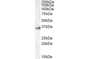 Image no. 1 for anti-LIM and SH3 Protein 1 (LASP1) (Internal Region) antibody (ABIN374893) (LASP1 Antikörper  (Internal Region))