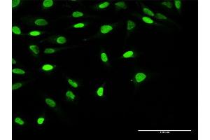 Immunofluorescence of purified MaxPab antibody to OBFC1 on HeLa cell. (OBFC1 Antikörper  (AA 1-368))