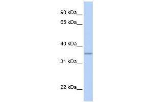 WB Suggested Anti-GRHPR Antibody Titration: 0. (GRHPR Antikörper  (N-Term))