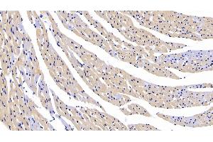 Detection of CTGF in Rat Cardiac Muscle Tissue using Polyclonal Antibody to Connective Tissue Growth Factor (CTGF) (CTGF Antikörper  (AA 118-388))