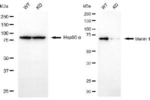Western blotting analysis using menin 1 antibody (ABIN7799493). (Rekombinanter Menin Antikörper)