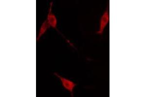 ABIN6267671 staining NIH-3T3 cells by IF/ICC. (TRKB Antikörper  (pTyr516))