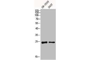 Western blot analysis of SH-SY5Y 293T using Dectin-2 antibody. (C-Type Lectin Domain Family 6, Member A (CLEC6A) (Internal Region) Antikörper)
