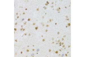 Immunohistochemistry of paraffin-embedded mouse brain using MCM4 Antibody (ABIN5971548) at dilution of 1/100 (40x lens). (MCM4 Antikörper)