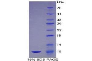 SDS-PAGE (SDS) image for Complement Component 5a (C5a) (AA 679-755) protein (His tag) (ABIN1079266)