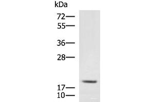 Western blot analysis of RAW264. (MRPL20 Antikörper)