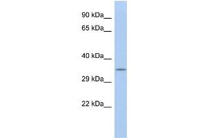 WB Suggested Anti-CALB2 Antibody Titration: 0. (Calretinin Antikörper  (N-Term))