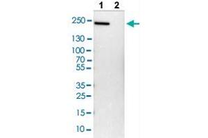 Western blot analysis of Lane 1: NIH/3T3 cell lysate and Lane 2: NBT-II cell lysate with LAMC1 polyclonal antibody .