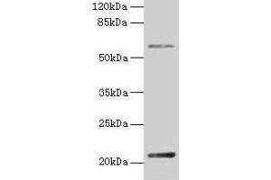 Western blot All lanes: DUSP13 antibody at 4 μg/mL + Hela whole cell lysate Secondary Goat polyclonal to rabbit IgG at 1/10000 dilution Predicted band size: 21, 23, 7, 28, 8, 10, 18 kDa Observed band size: 21 kDa (DUSP13 Antikörper  (AA 1-198))